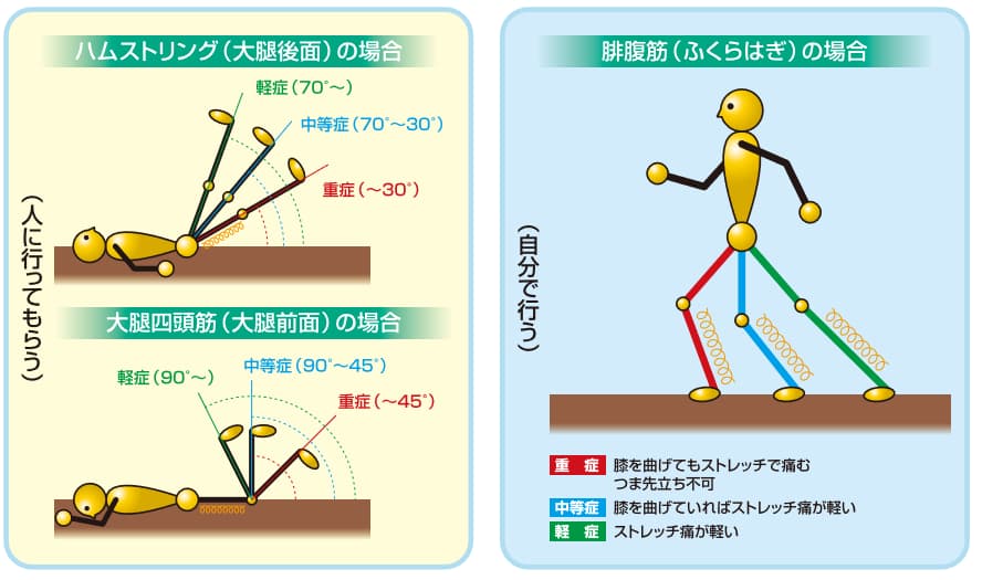 肉離れの症状 診断 重症度 治療について 足立慶友整形外科