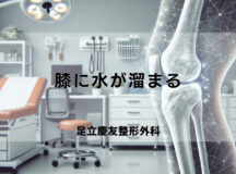膝に水が溜まる原因と治療の選択肢を詳しく知る手引き