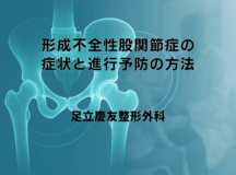 形成不全性股関節症の症状と進行予防の方法