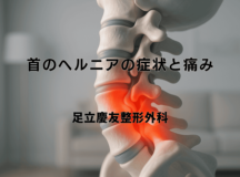 首のヘルニアの症状と痛み｜手術が必要なケースとは