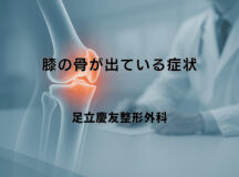 膝の骨が出ている症状｜大人の方が気をつけるべきこと