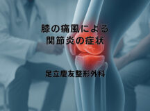 膝の痛風による関節炎の症状と早期発見の大切さ