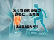 変形性膝関節症の運動による改善 – 効果的な治療法
