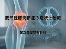 変形性膝関節症の症状と治療 – 専門医による解説