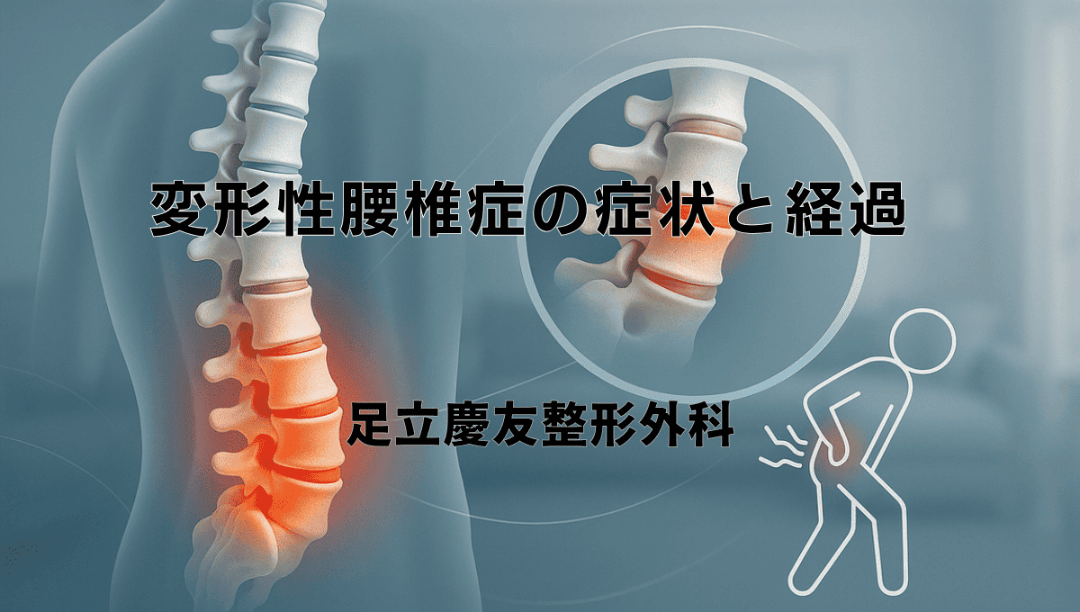 変形性腰椎症の症状と経過 - 日常生活での注意点