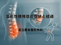 変形性腰椎症の症状と経過 – 日常生活での注意点