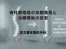 脊柱側弯症の早期発見と治療開始の目安について