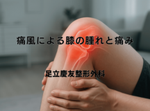痛風による膝の腫れと痛み – 発症部位と特徴的な症状