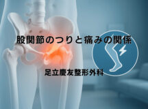 股関節のつりと痛みの関係｜予防と対処の方法