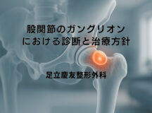 股関節のガングリオンにおける診断と治療方針