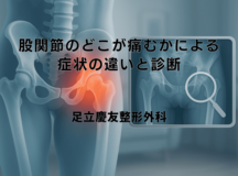 股関節のどこが痛むかによる症状の違いと診断