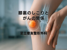 膝裏のしこりとがんの関係 – 専門医の見解