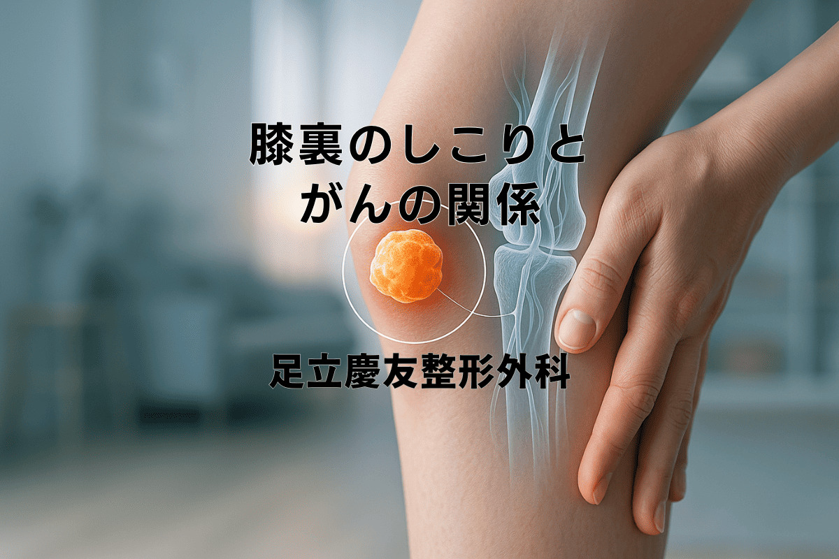 膝 の 裏 腫れ