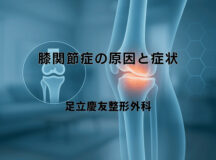 膝関節症の原因と症状｜治療法の選択基準