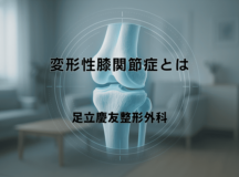 変形性膝関節症とは｜症状と治療の基礎知識