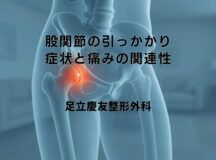 股関節の引っかかり症状と痛みの関連性