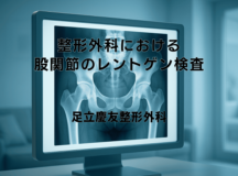 整形外科における股関節のレントゲン検査の重要性