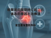 股関節の開閉時に起こる痛みの原因と治療法