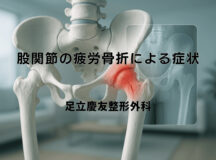 股関節の疲労骨折による症状と回復期の注意点