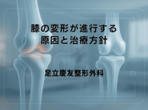 膝の変形が進行する原因と治療方針