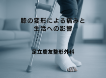 膝の変形による痛みと生活への影響 – 対処法と治療