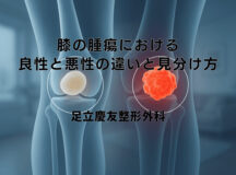 膝の腫瘍における良性と悪性の違いと見分け方