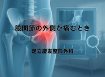 股関節の外側が痛むときに疑われる疾患と検査