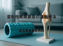 変形性膝関節症の運動療法｜効果的な進め方
