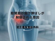股関節の曲げ伸ばしが制限される原因とは