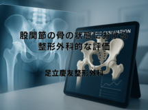 股関節の骨の状態における整形外科的な評価