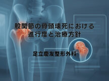 股関節の骨頭壊死における進行度と治療方針