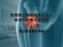股関節の骨棘形成による症状と治療の選択肢