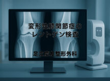 変形性膝関節症のレントゲン検査｜画像診断の意義