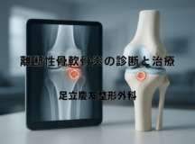離断性骨軟骨炎の診断と治療｜専門医の解説