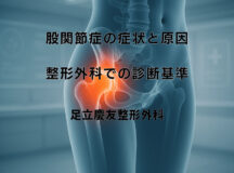 股関節症の症状と原因|整形外科での診断基準