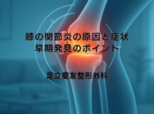 膝の関節炎の原因と症状｜早期発見のポイント