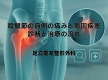 股関節の前側の痛みと原因疾患｜診断と治療の流れ