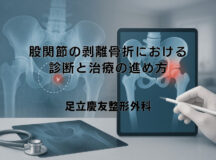 股関節の剥離骨折における診断と治療の進め方