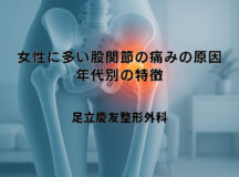 女性に多い股関節の痛みの原因｜年代別の特徴