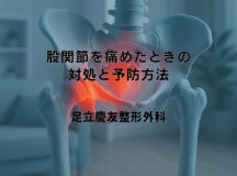 股関節を痛めたときの対処と予防方法