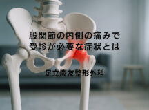 股関節の内側の痛みで受診が必要な症状とは