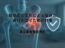 股関節の変形による症状と進行を防ぐための対策
