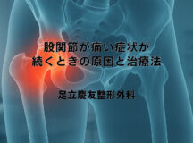 股関節が痛い症状が続くときの原因と治療法