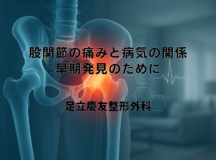 股関節の痛みと病気の関係｜早期発見のために