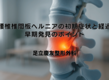腰椎椎間板ヘルニアの初期症状と経過｜早期発見のポイント