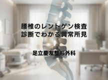 腰椎のレントゲン検査 – 診断でわかる異常所見