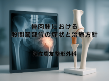 骨肉腫における股関節部位の症状と治療方針