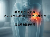 股関節の病気はどのような症状で発見されるか