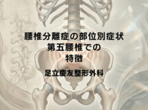 腰椎分離症の部位別症状｜第五腰椎での特徴