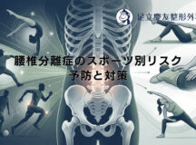 腰椎分離症のスポーツ別リスク – 予防と対策